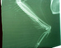 Broken radius and ulna Red-tailed hawk